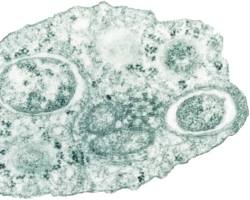 Wolbachia pipientisの画像