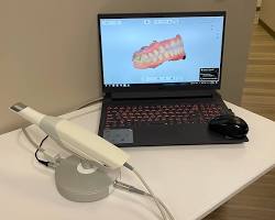 Image of 3Shape dental scanner