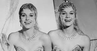 Las icónicas gemelas Kessler perdieron la vida al mismo tiempo y la razón nos rompió totalmente