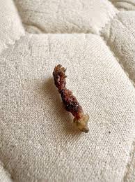 I woke up feeling like something was biŧing my upper back ...