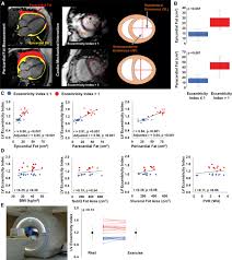 The Impact of Excess Pericardial Fat on Cardio-Mechanical Function in Heart Failure with Preserved Ejection Fraction