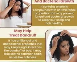 Image of Apple Cider Vinegar for Dandruff