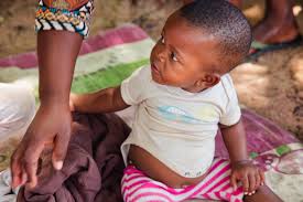 Quick takes: Bhattacharya addresses CDC, end of aid to 7 Africa nations, ACOG pulls out of ACIP