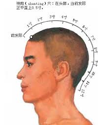 Some Useful Acupuncture Points For Headache Relief - Shen-Ting2-1