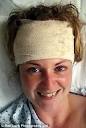 Ice skater's life saved after tumble reveals deadly brain tumour ... - article-2050061-0E699B3400000578-76_306x454
