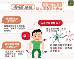 纖維肌痛症示意圖的圖片