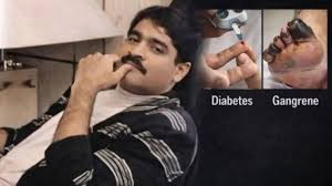 What Is Ailing Dawood Ibrahim? Diabetes, Gangrene, and Poisoning Rumours Fuel Health Speculation