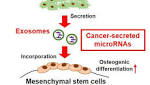  Metastasizing cancer cells modify bone remodeling with small RNA secretion