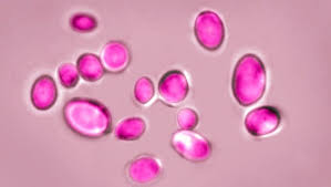 Texas leads US in cases of dangerous fungal infection