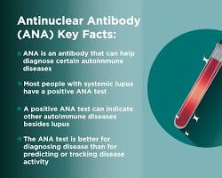 صورة Antinuclear antibody (ANA) test