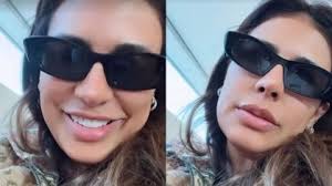 Simone Mendes rebate comentários sobre mudança no nariz: "Vai cair"