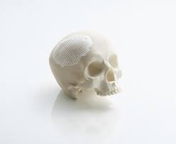 Ceramic 3D printing: Medical