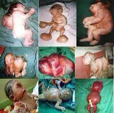 Image result for depleted+uranium+babies