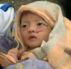 Anak Yatim Piatu di Daerah Bencana Harus Segera Diadopsi foto - korbantsunami6