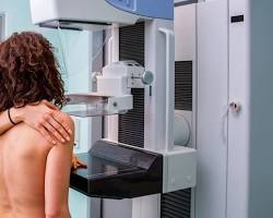 صورة women getting mammograms
