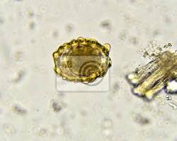 Imagem de Ascaris lumbricoides, vermes redondos