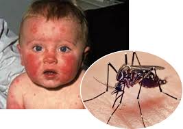 Image result for virus zika