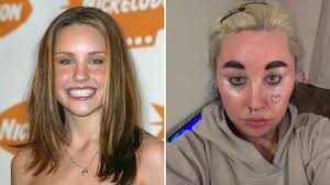 Amanda Bynes Shows Off Septum Piercing and Bleached Hair Amid Weight-Loss Journey in Rare Photos