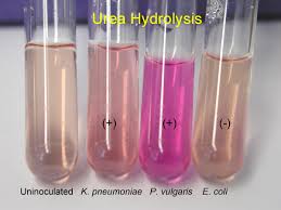 urea hydrolysis test
