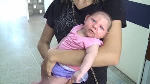 Image result for images of zika babies