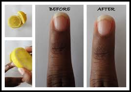 Image result for baking soda and lemon