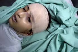 Image result for depleted+uranium+babies