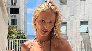 Yasmin Brunet conta que 'bêbado na rua' percebeu lipedema antes dos médicos