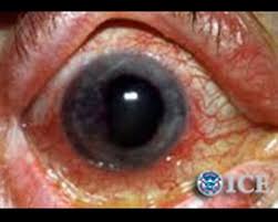 Bildergebnis für colored contacts