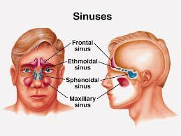 obat herbal radang sinusitis