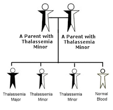 Image result for thalassemia disease