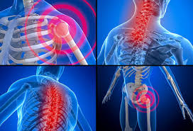 Bildresultat för fibromyalgia back pain down leg