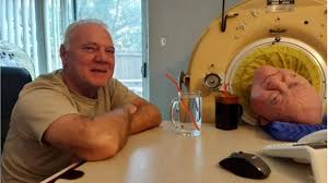 A six-year-old entered an iron lung after polio. More than 70 years later, he had become the world’s long