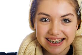 Image result for orthodontics