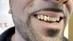 Image result for teeth grillz