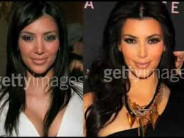 Résultat de recherche d'images pour "who is kim kardashian before and after"