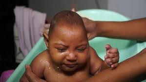 Image result wey dey for images of zika babies