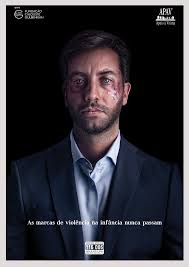 SOUSEL: BOMBEIROS, GNR E CENTRO DE SAÚDE JÁ TÊM VISEIRAS DE PROTEÇÃO