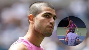 Alcaraz vs. Lehecka: ¿Otro Paso Firme Hacia el Título del US Open? - Imagen principal del artículo