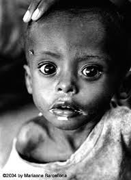 The consumption of animals supports world hunger,. this is against God&#39;s instructions in the Bible. - starving%2520child