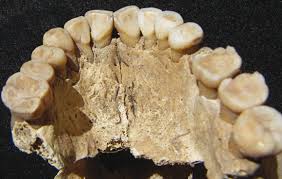 Résultat de recherche d'images pour "shovel shaped incisors"