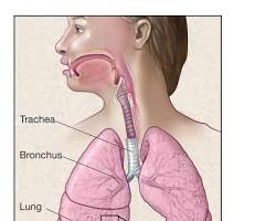 Image of Asbestosis lungs