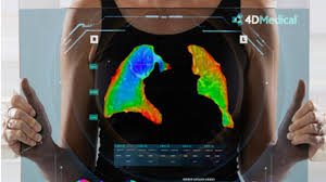 4DMedical (ASX:4DX) Secures $1.1m in CTCM Funding to Advance XV Scanner Technology - 6