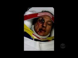 Image result for takata recall