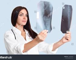Image of radiologist looking at an Xray with a surprised expression