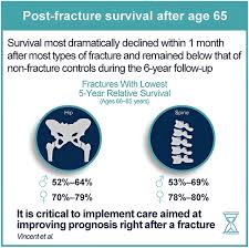 hip fracture Comparison of Survival Rates between Hip/Spine Fractures and Various Cancers