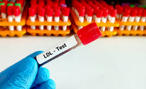 Doctors just updated the cholesterol number that aligns closest with heart disease risk