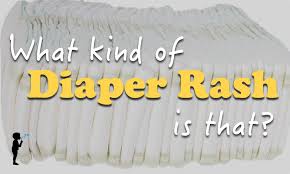 Image result for newborn diaper rash