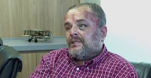 Advogado acusa PMs de agressão após questionamentos sobre OAB digital