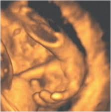 Figure 14, a 3-D ultrasound image of a fetal hand at 34 weeks gestation. Image courtesy of Stefano Ciatti, M.D. - 2003_12_30_14_26_25_706