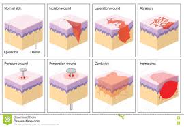 Resultado de imagen de tipos de heridas
